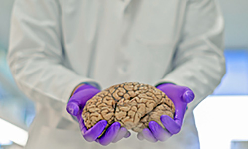 Doctor holding an example brain in his hands