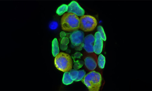 Microsopic view of research specimen