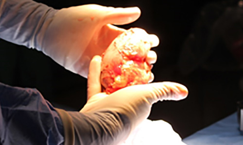 Doctor holding transplant organ