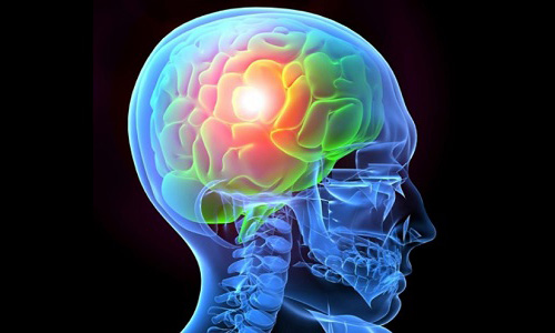 Graphic design of a brain lit up